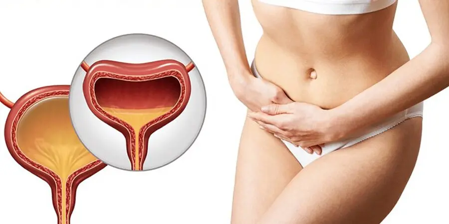 Uterus and Vagina Sagging