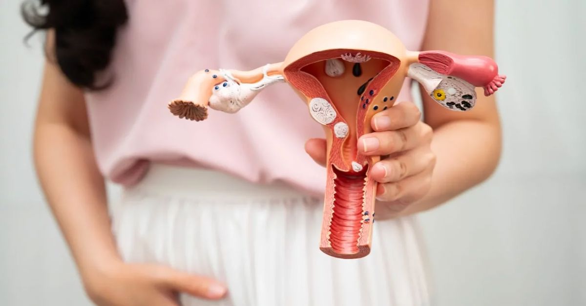 Симптомы выпадения матки Симптомы выпадения матки