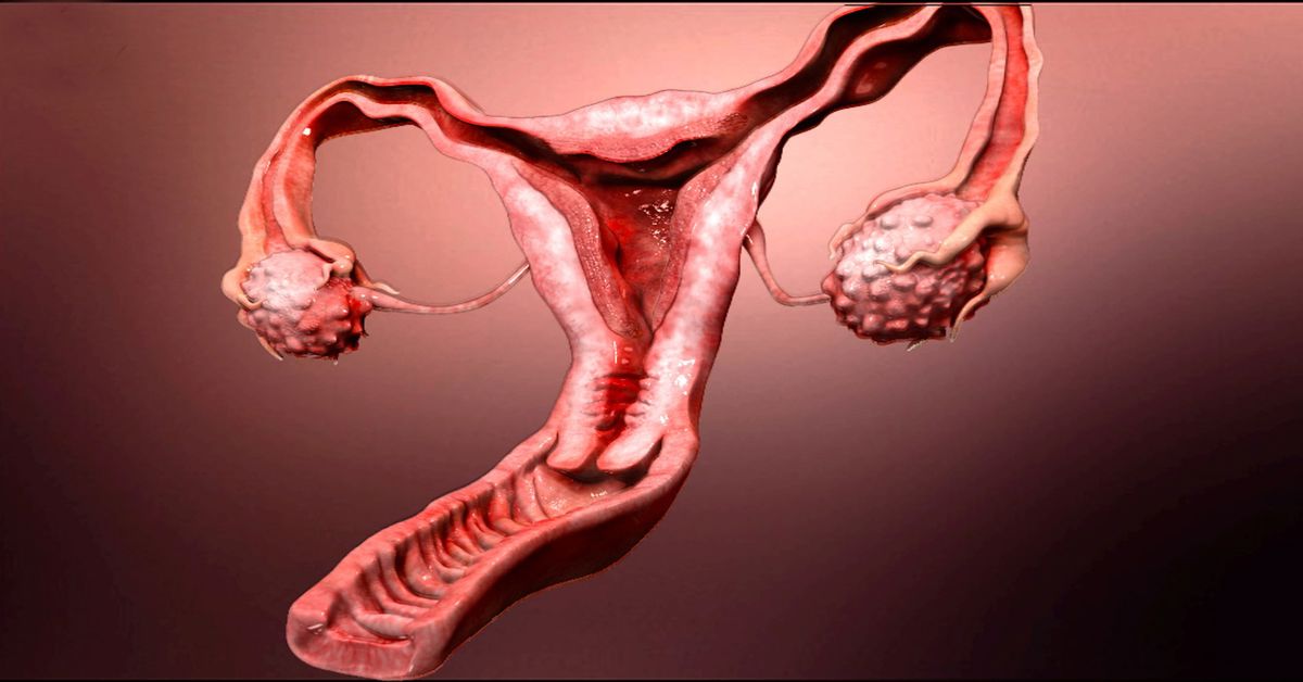 Vaginal Prolapse Surgery Vaginal Prolapse Surgery