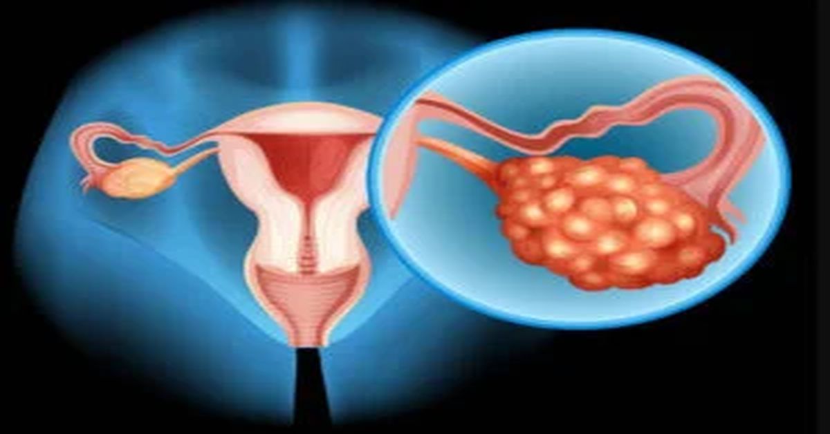 Cervical Inflammation Cervical Inflammation