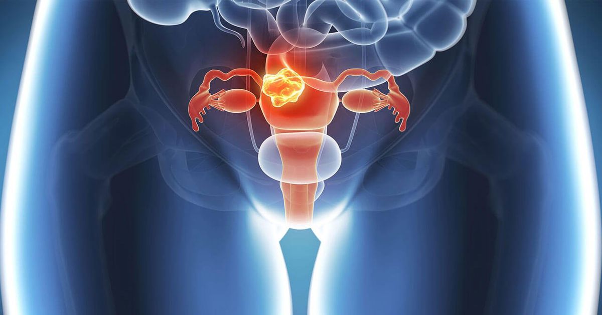 Cervical Infection Cervical Infection