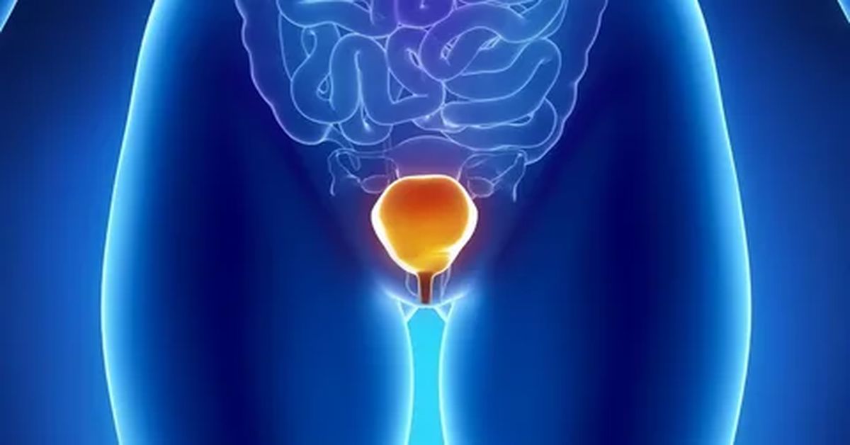 Mesane İltihabı Tedavisi