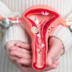 Rahim Sarkması Tedavisi