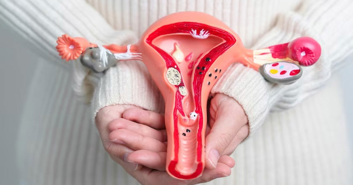 Rahim Sarkması Tedavisi