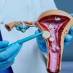 Rahim Tümörü Ameliyatı