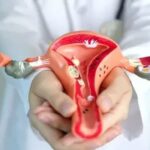 Rahim Tümörü Tedavisi