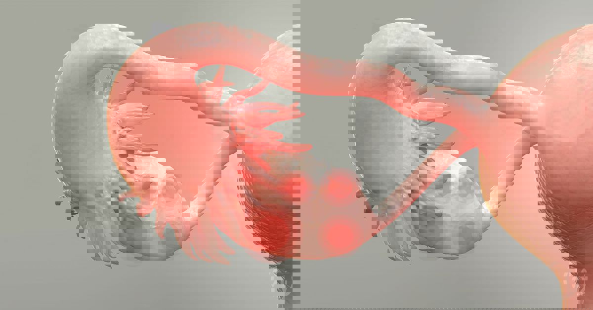 Yumurtalık Kisti Ameliyatı Yumurtalık Kisti Ameliyatı