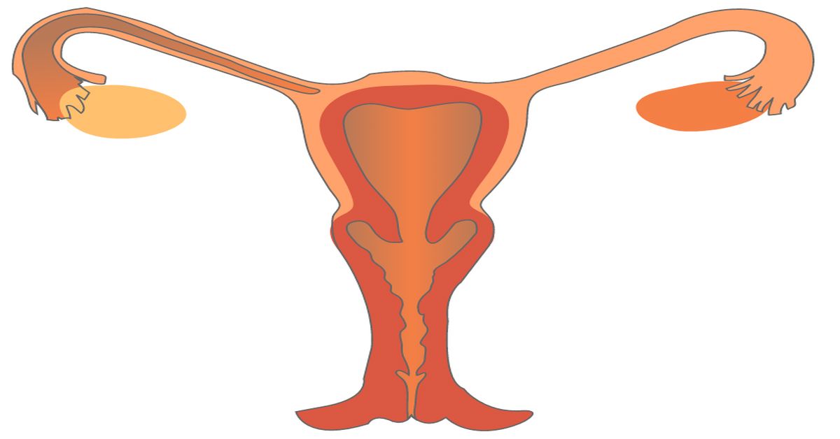 Yumurtalık Tümörü Ameliyatı Yumurtalık Tümörü Ameliyatı